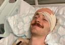 Jack Chambers in hospital with after brain tumour surgery